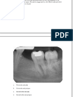 Endodontic Mcqs - DocShare - Tips 2