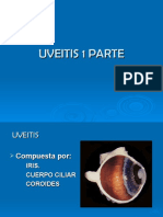 UVEITIS