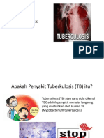 Presentation TB Paru