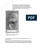 Traumatismos Perimortem - Postmortem