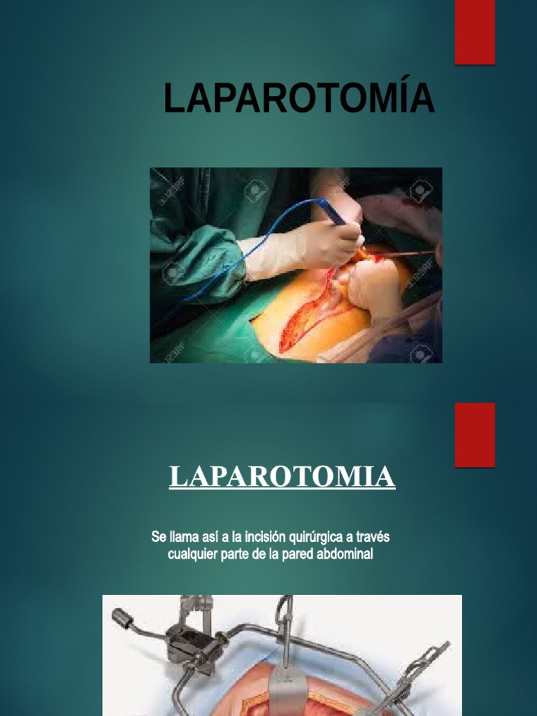 t-cnicas-de-laparotom-a-quir-rgica-pdf-h-gado-abdomen