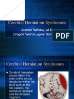 Neuro 2012 Halliday Presentation Cerebral Herniation Syndrome.pdf