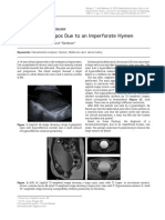 Hematometrocolpos Due To An Imperforate Hymen: Thomas Bekaert and Kristof Ramboer