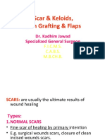 Scar & Keloids, Skin Grafting & Flaps: Dr. Kadhim Jawad Specialized General Surgeon