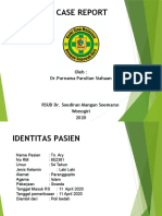 Case Report Hidrocele