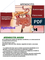 apendicitis y colecistectomia (1)