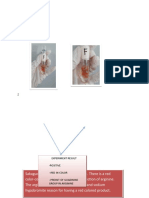 Data and Results F. Sakaguchi Test: Experiment Result - Positive - Red in Color - Presnt of Guadinine Group in Arginine