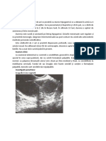 06 c15 Endometrioza