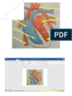 corazon examen.docx