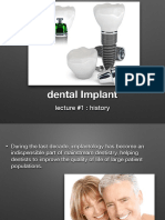 Dental Implant History