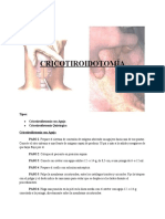 Cricotiroidotomía