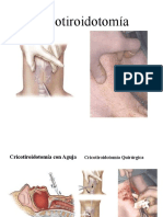 Fin Cricotiroidotomía.pptx