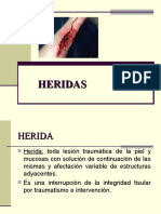 Heridas