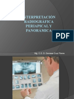 Interpretación Radiográfica Periapical y Panorámica
