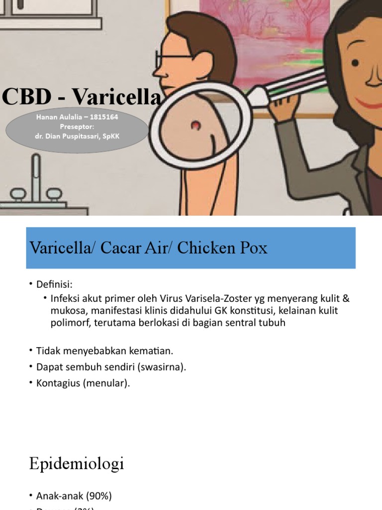 Varicella dan Herpes Zoster: Gejala dan Pengobatan | PDF