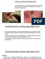 Estomatitis Aftosa Recidivante