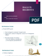 HALLUX RIGIDITUS12