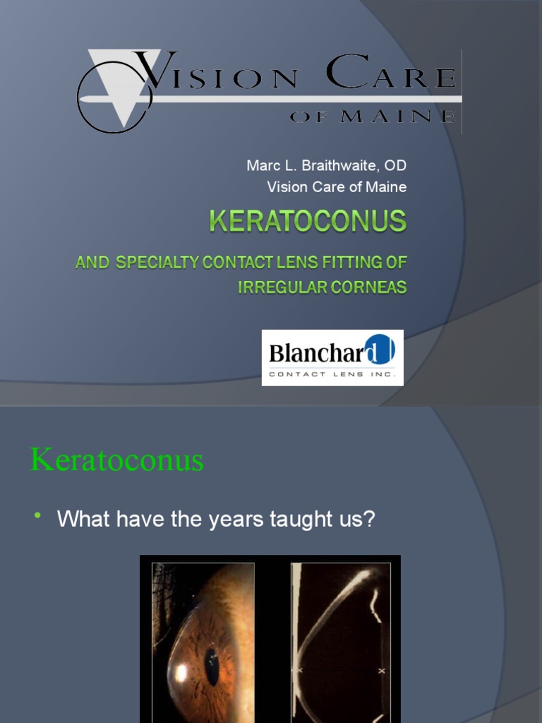 Marc L. Braithwaite, OD Vision Care of Maine PDF Cornea Contact Lens