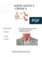 Esofagitis Aguda y Crónica