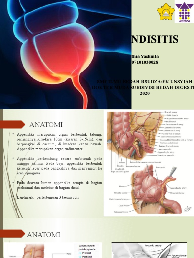 Appendisitis | PDF