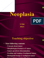 Neoplasia: Li Qun 2016.9