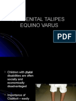 Congenital Talipes Equino Varus