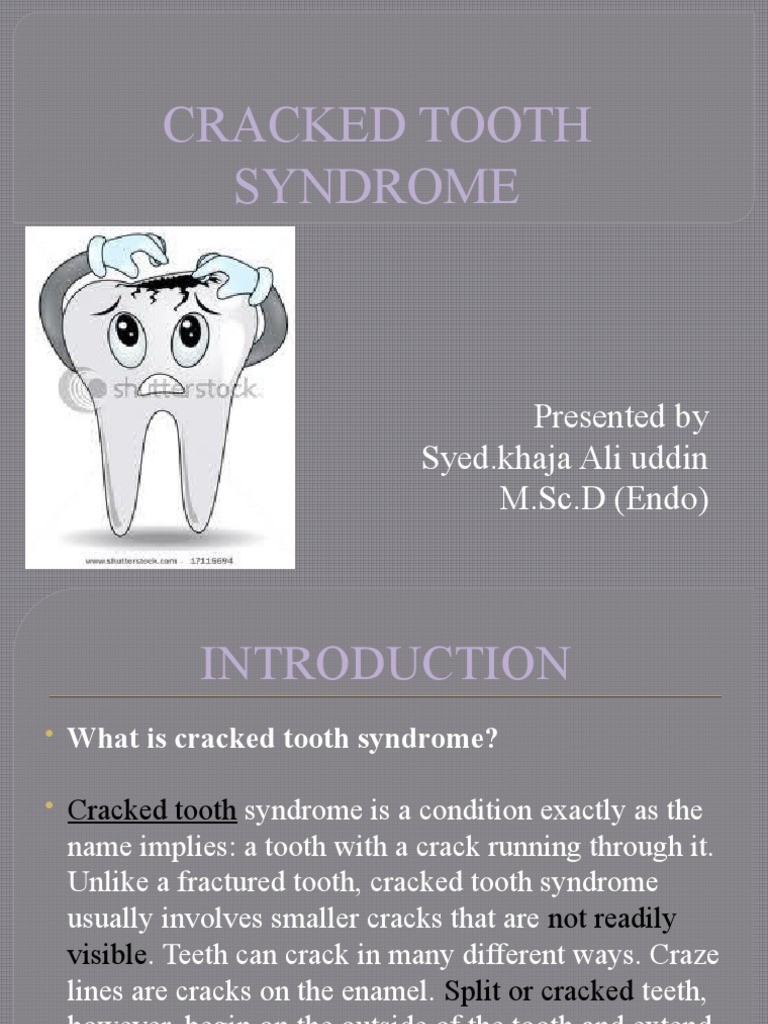 Cracked Tooth Syndrome Overview | PDF | Human Tooth | Symptoms And ...