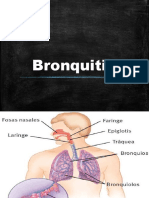 Bronquitis