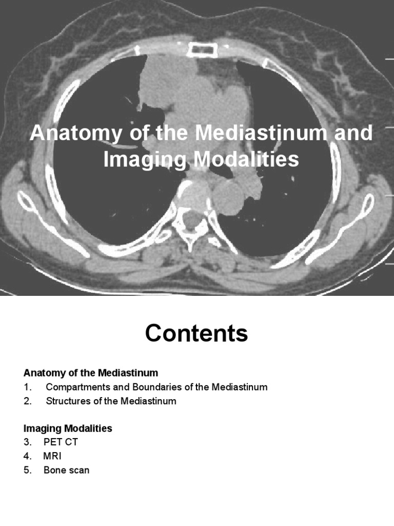 Anatomy of The Mediastinum and Imaging Modalities | PDF | Aorta | Esophagus
