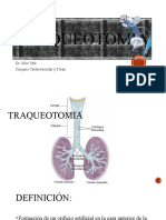 TRAQUEOTOMIA