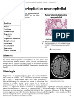 Tumor Disembrioplástico Neuroepitelial - Wikipedia, La Enciclopedia Libre