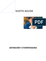 Sinusitis aguda: definición, clasificación, etiología y tratamiento