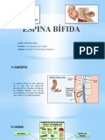 Espina bifida