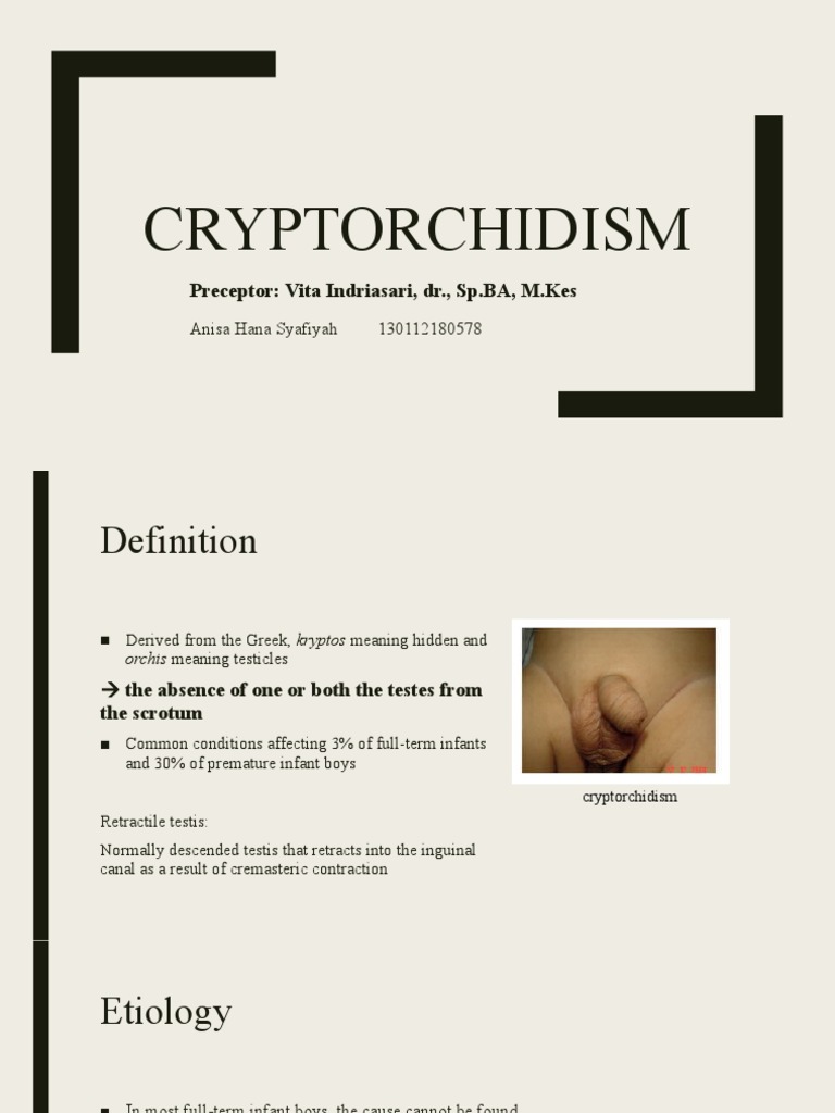 Cryptorchidism: Preceptor: Vita Indriasari, DR., SP - BA, M.Kes | PDF ...