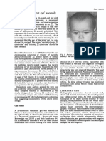 Trisomy 22 with 'cat eye' anomaly.pdf