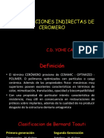 Restauraciones indirectas de cerómero: ventajas y casos clínicos