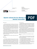 Ajuste Oclusal de Los Dientes en La Protesis Dental Removible PDF
