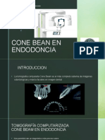 Cone Bean en Endodoncia