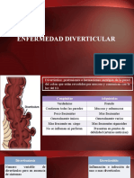 Diverticulitis