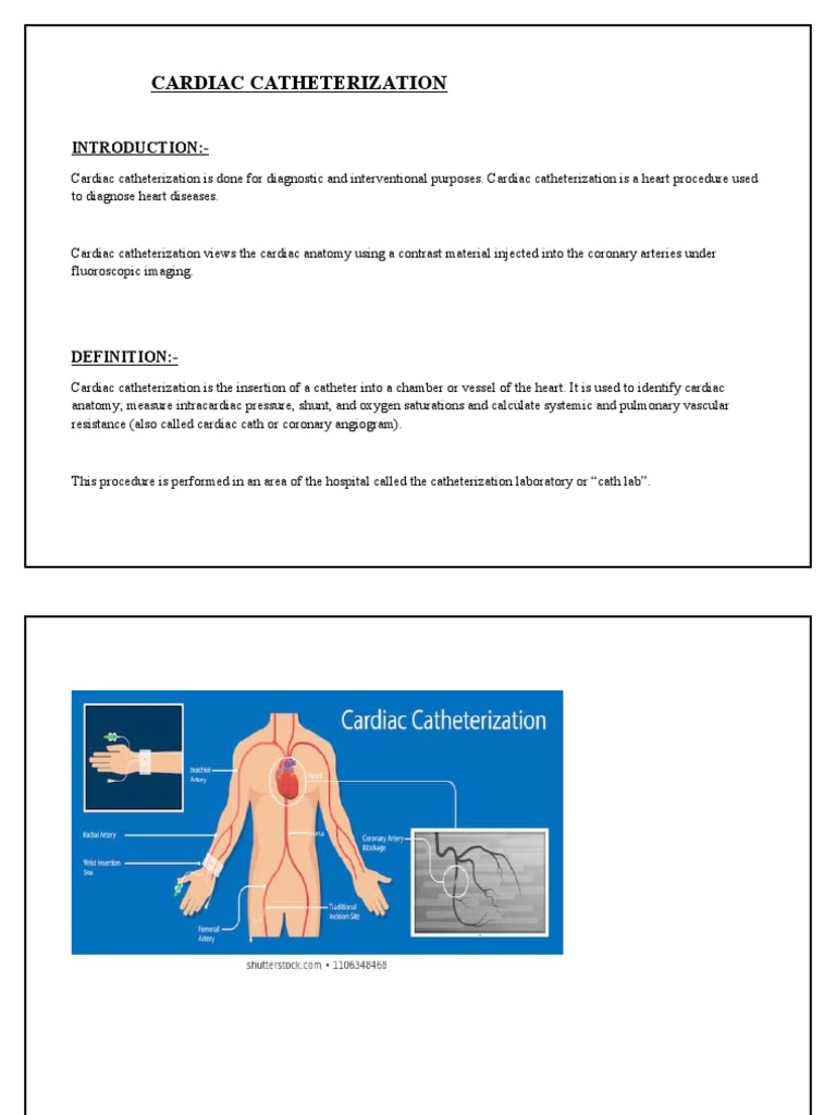 Cardiac Catheterization Procedure | PDF | Heart | Circulatory System