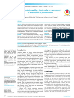 Four Rooted Maxillary Third Molar A Case Report of