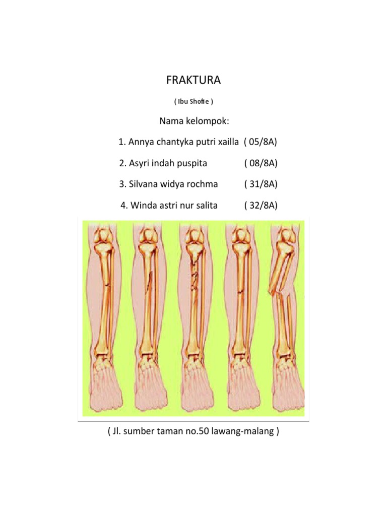 Fraktura 1 | PDF