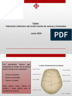 Suturas y Fontanelas-1