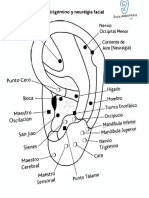 2 - Neuralgia Facial y Trigémino