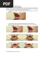 ejercicios-post-frenectomia-pdf