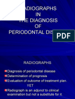 Radio Graphic Aids - Diagnosis Periodontal Diseases Kalps