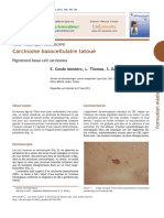 Dermato Carcinome Baso Dermoscopie Condemontero2013 PDF