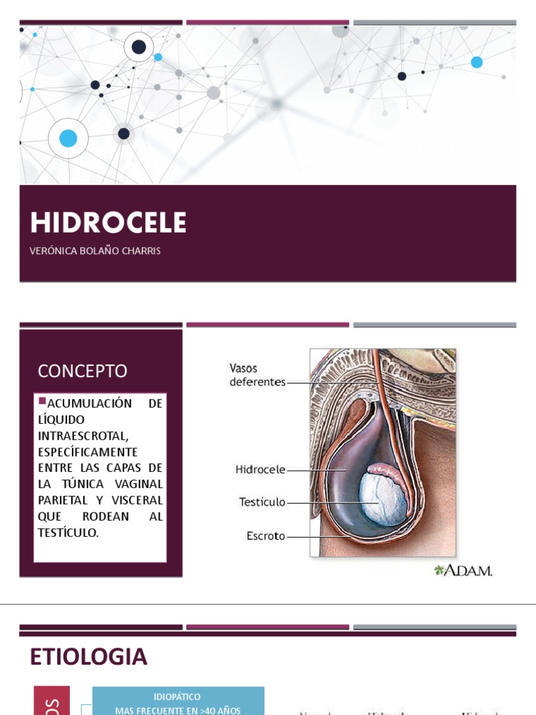 hidrocele-en-ni-os-care-guide-information-en-espanol-qsvvvo