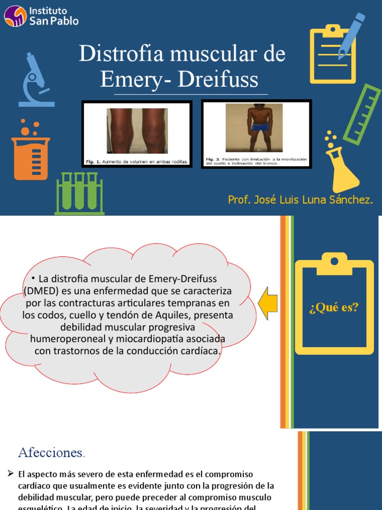 Distrofia Muscular de Emery-Dreifuss | PDF | Rodilla | Pie