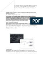 Para La Exploracion Ecografica de La Cadera Utilizaremos Sondas Lineales Multifrecuencia Que Suelen Emitir Entre 5 y 12 MHZ